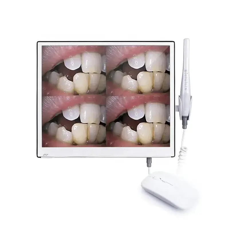 Cameră Intraorală WiFi Wisedent DA300 cu Monitor Full HD 17 inch și Suport
