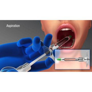 Seringa aspirație Pluraject 2 3M ESPE